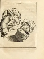 Picture 10 of 41 from Miscellanea curiosa, sive, Ephemeridum medico-physicarum Germanicarum (1700), leaf 56