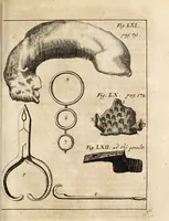 An illustration from Miscellanea curiosa, sive, Ephemeridum medico-physicarum Germanicarum (1700)