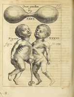 An illustration from Miscellanea Curiosa, sive Ephemiridum Medico-Physicarum Germanicarum Academiae Naturae Curiosorum (1686)
