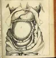 An illustration from Miscellanea Curiosa Medico-Physica Academiae Naturae Curiosorum (1676)