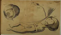 Picture 2 of 62 from Miscellanea Curiosa Medico-Physica Academiae Naturae Curiosorum (1676), leaf 40