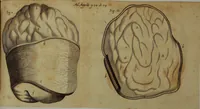 An illustration from Miscellanea Curiosa Medico-Physica Academiae Naturae Curiosorum (1676)