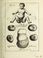 An illustration from Miscellanea Curiosa, sive Ephemiridum Medico-Physicarum Germanicarum Academiae Naturae Curiosorum (1687)