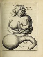 An illustration from Miscellanea Curiosa, sive Ephemiridum Medico-Physicarum Germanicarum Academiae Naturae Curiosorum (1700)