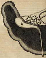 An illustration from Miscellanea Curiosa, sive Ephemiridum Medico-Physicarum Germanicarum Academiae Naturae Curiosorum (1700)