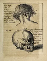 An illustration from Miscellanea Curiosa, sive Ephemiridum Medico-Physicarum Germanicarum Academiae Naturae Curiosorum (1700)