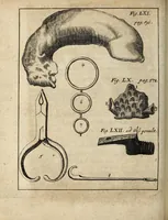 An illustration from Miscellanea Curiosa, sive Ephemiridum Medico-Physicarum Germanicarum Academiae Naturae Curiosorum (1700)