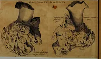 An illustration from Miscellanea Curiosa Medico-Physica Academiae Naturae Curiosorum (1677)