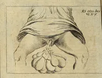 Picture 8 of 43 from Miscellanea Curiosa Medico-Physica Academiae Naturae Curiosorum (1677), leaf 59