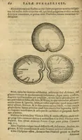 Picture 1 of 2 from De simplicibus medicamentis ex occidentali India delatis quorum in medicina usus est /Auctore Nicolao Monardis.Interprete Carolo Cliusio Atrebate. (1574), leaf 64