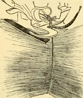 An illustration from Modern mechanism, exhibiting the latest progress in machines, motors, and the transmission of power, being a supplementary volume to Appletons' cyclopaedia of applied mechanics (1892)
