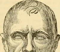 An illustration from My battle for life. The autobiography of a phrenologist (1857)