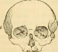 An illustration from My battle for life. The autobiography of a phrenologist (1857)
