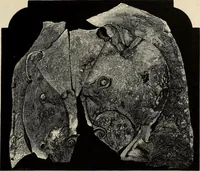 Picture 139 of 311 from Mycenae : a narrative of researches and discoveries at Mycenae and Tiryns (1878), leaf 299