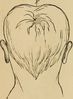 Picture 18 of 86 from The mysteries of the head and the heart explained : including an improved system of phrenology, a new theory of the emotions, and an explanation of the mysteries of mesmerism, trance, mind-reading, and the spirit delusion (1875), leaf 103