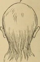 Picture 19 of 86 from The mysteries of the head and the heart explained : including an improved system of phrenology, a new theory of the emotions, and an explanation of the mysteries of mesmerism, trance, mind-reading, and the spirit delusion (1875), leaf 103