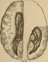 Picture 43 of 86 from The mysteries of the head and the heart explained : including an improved system of phrenology, a new theory of the emotions, and an explanation of the mysteries of mesmerism, trance, mind-reading, and the spirit delusion (1875), leaf 196