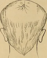Picture 11 of 86 from The mysteries of the head and the heart explained : including an improved system of phrenology, a new theory of the emotions, and an explanation of the mysteries of mesmerism, trance, mind-reading, and the spirit delusion (1875), leaf 73