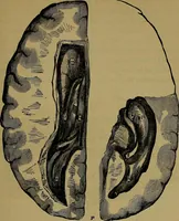 An illustration from The mysteries of the head and the heart explained: including an improved system of phrenology; a new theory of the emotions, and an explanation of the mysteries of mesmerism, trance, mind-reading, and the spirit delusion (1881)