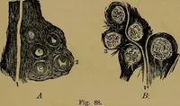 Picture 62 of 68 from The mysteries of the head and the heart explained: including an improved system of phrenology; a new theory of the emotions, and an explanation of the mysteries of mesmerism, trance, mind-reading, and the spirit delusion (1881), leaf 234