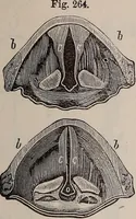 An illustration from A natural philosophy : embracing the most recent discoveries in the various branches of physics, and exhibiting the application of scientific principles in everyday life .. (1899)