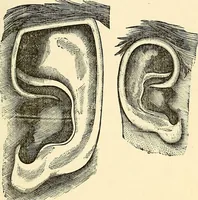 An illustration from Nature's revelations of character; or, physiognomy illustrated. A description of the mental, moral and volitive dispositions of mankind, as manifested in the human form and countenance (1879)