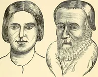 An illustration from Nature's revelations of character; or, physiognomy illustrated. A description of the mental, moral and volitive dispositions of mankind, as manifested in the human form and countenance (1879)