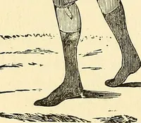 An illustration from Nature's revelations of character; or, physiognomy illustrated. A description of the mental, moral and volitive dispositions of mankind, as manifested in the human form and countenance (1879)