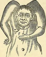 An illustration from Nature's revelations of character; or, physiognomy illustrated. A description of the mental, moral and volitive dispositions of mankind, as manifested in the human form and countenance (1879)