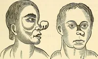 An illustration from Nature's revelations of character; or, physiognomy illustrated. A description of the mental, moral and volitive dispositions of mankind, as manifested in the human form and countenance (1879)