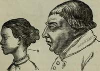 An illustration from Nature's revelations of character, or, Physiognomy illustrated : a description of the mental, moral and volitive dispositions of mankind, as manifested in the human form and countenance (1887)
