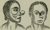 An illustration from Nature's revelations of character, or, Physiognomy illustrated : a description of the mental, moral and volitive dispositions of mankind, as manifested in the human form and countenance (1887)