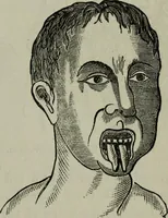 An illustration from Nature's revelations of character, or, Physiognomy illustrated : a description of the mental, moral and volitive dispositions of mankind, as manifested in the human form and countenance (1887)