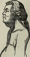 An illustration from Nature's revelations of character, or, Physiognomy illustrated : a description of the mental, moral and volitive dispositions of mankind, as manifested in the human form and countenance (1887)