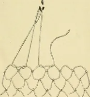 An illustration from Needle-craft: artistic and practical (1889)