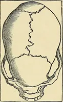 An illustration from A new illustrated hand-book of phrenology, physiology and physiognomy (1878)