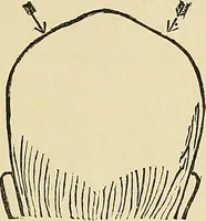 An illustration from A new illustrated hand-book of phrenology, physiology and physiognomy (1878)