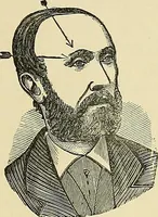 An illustration from A new illustrated hand-book of phrenology, physiology and physiognomy (1878)