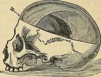 An illustration from A new illustrated hand-book of phrenology, physiology and physiognomy (1878)