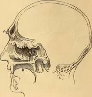 Picture 107 of 693 from New physiognomy (1867), leaf 151