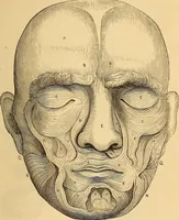 Picture 108 of 693 from New physiognomy (1867), leaf 152