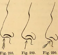 Picture 179 of 693 from New physiognomy (1867), leaf 215