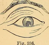 Picture 209 of 693 from New physiognomy (1867), leaf 239