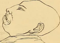 An illustration from New physiognomy (1867)