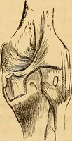 Picture 37 of 693 from New physiognomy (1867), leaf 80