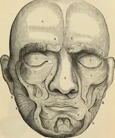 Picture 109 of 697 from New Physiognomy : or signs of character, as manifested through temperament and external forms, and especially in the "the human face divine." (1889), leaf 152