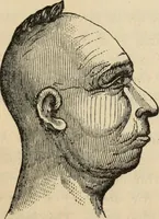 Picture 116 of 697 from New Physiognomy : or signs of character, as manifested through temperament and external forms, and especially in the "the human face divine." (1889), leaf 160