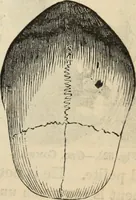Picture 375 of 697 from New Physiognomy : or signs of character, as manifested through temperament and external forms, and especially in the "the human face divine." (1889), leaf 420