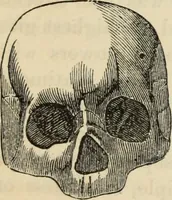 Picture 403 of 697 from New Physiognomy : or signs of character, as manifested through temperament and external forms, and especially in the "the human face divine." (1889), leaf 444