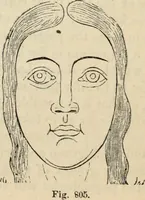 Picture 527 of 697 from New Physiognomy : or signs of character, as manifested through temperament and external forms, and especially in the "the human face divine." (1889), leaf 594